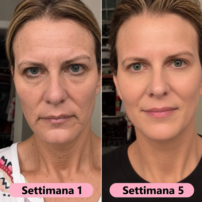 Siero Coreano al Collagene | Effetto Volume per Pelli Mature